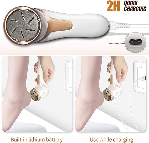 Storm Foot Grinder – Smooth Feet Instantly, Powerful Callus Remover Tool